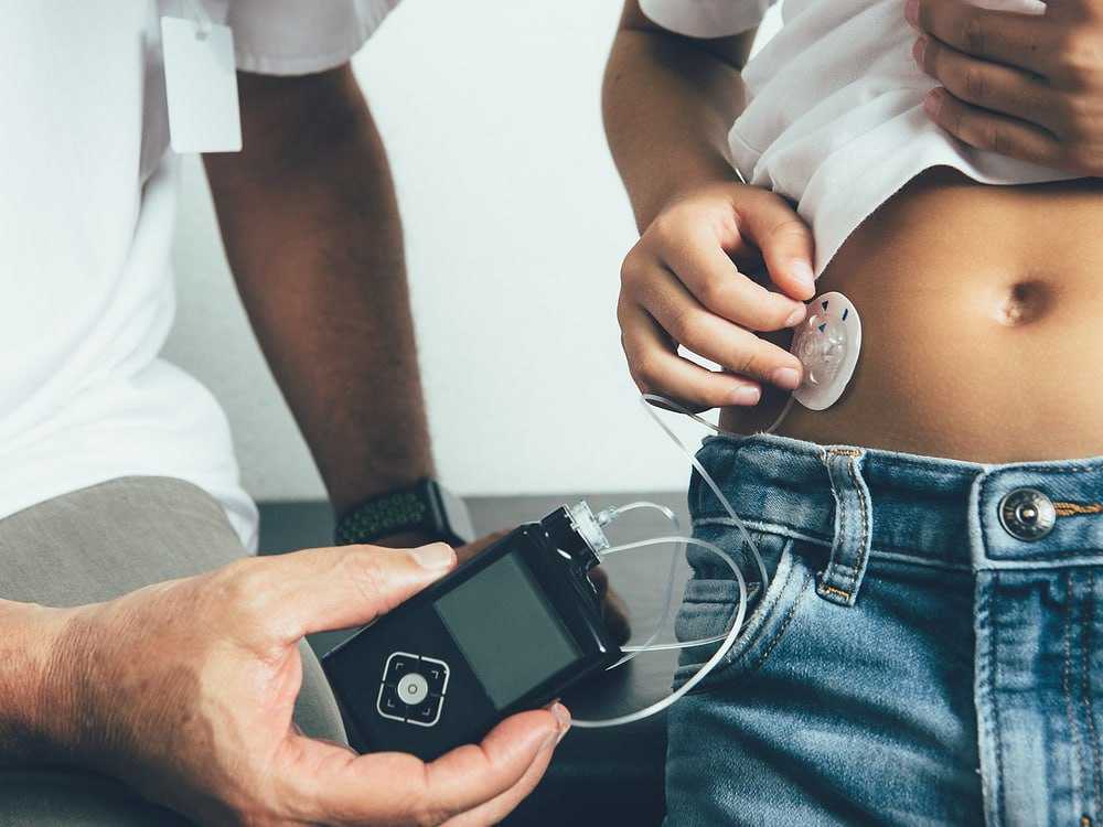 У громаді стартує видача інсулінових помп дітям