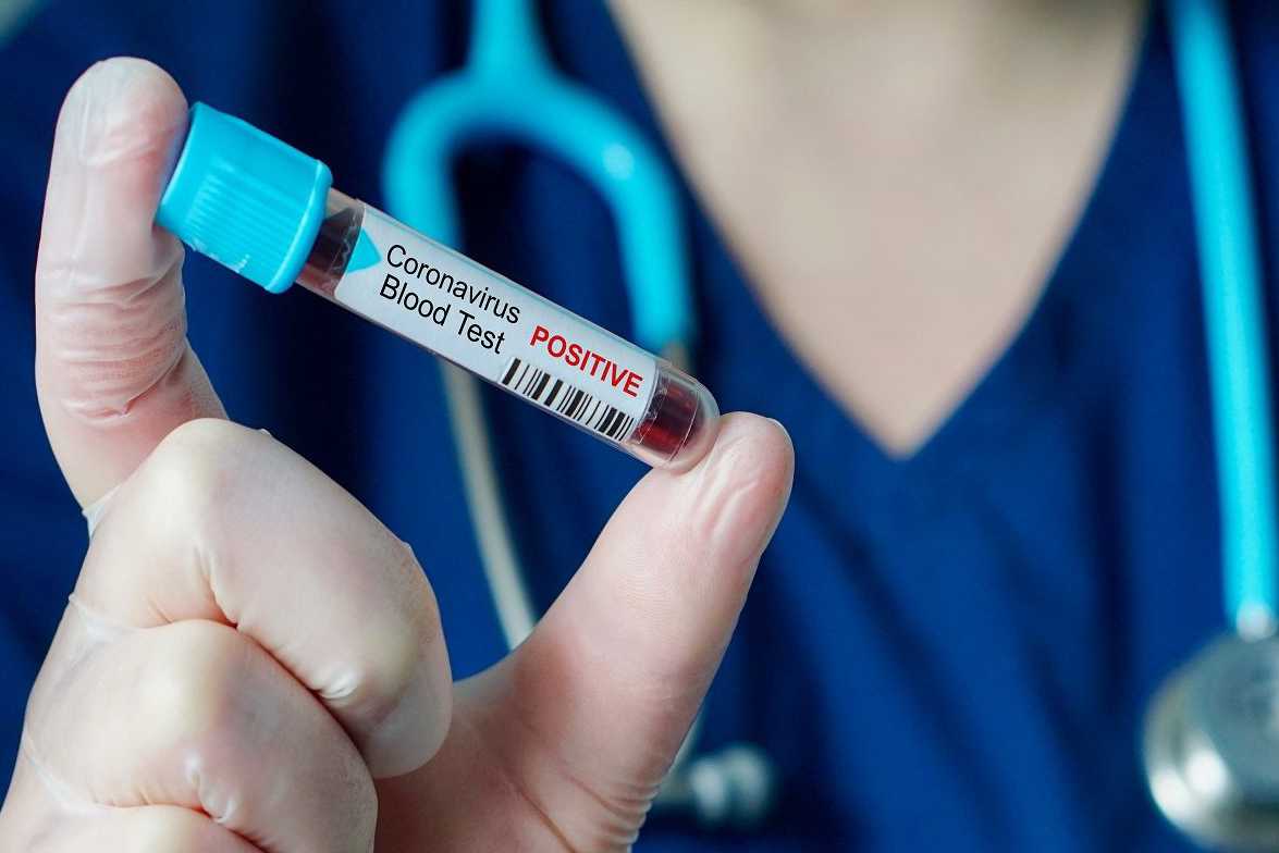 Рівень захворюваності на ковід зростає