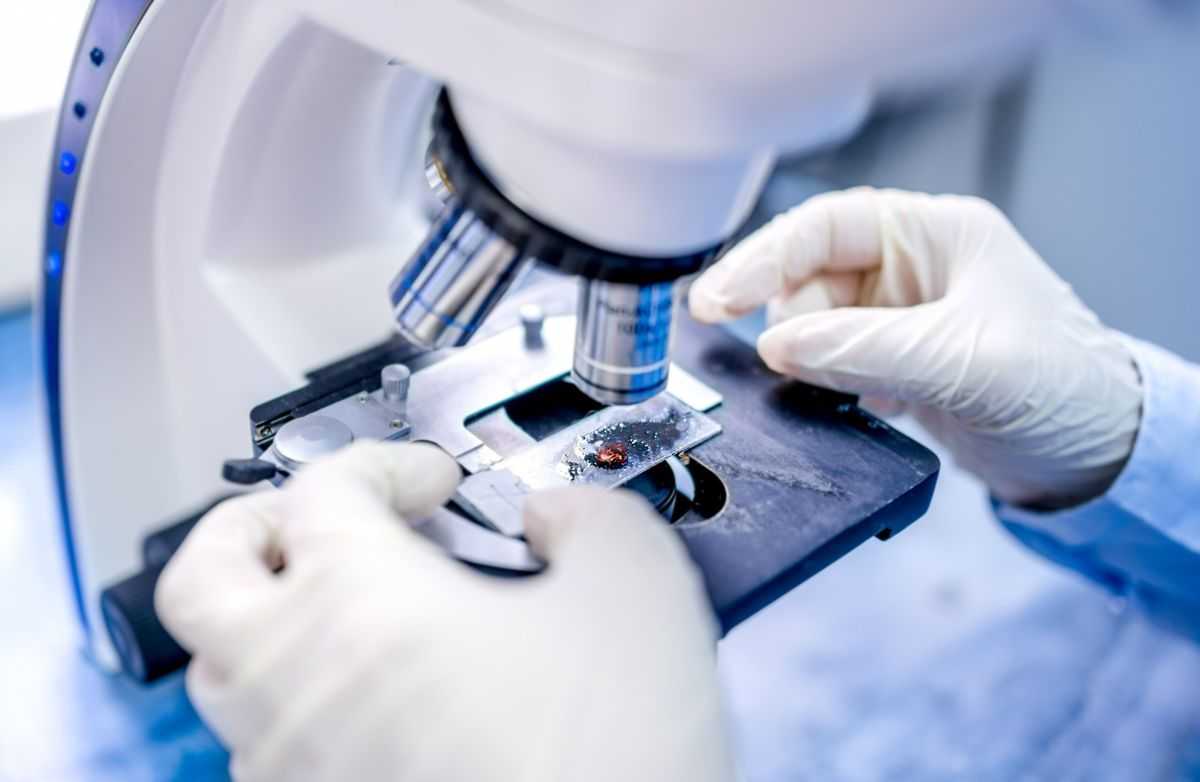 Як вберегтись від гострих кишкових інфекцій?